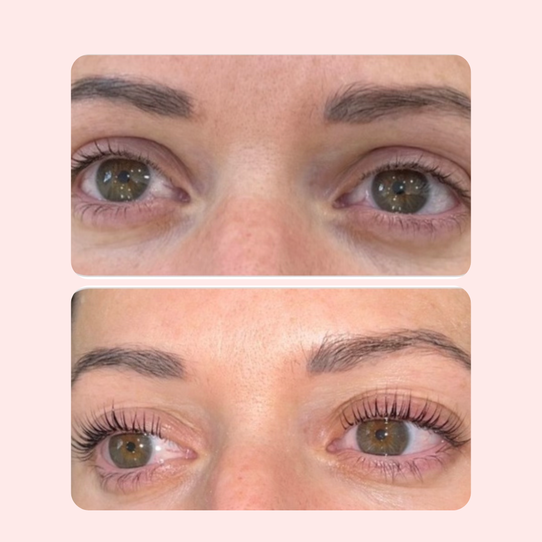 LASH & BROW SERUM